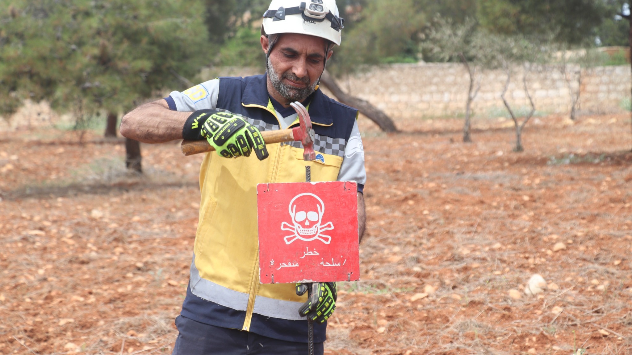 The victim of smugglers.. A man loses his leg in Talkalakh