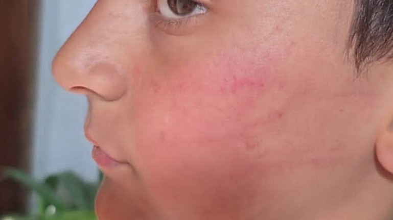 ضرب طالب في انخل يشعل جدلاً واسعاً حول حدود دور المعلم