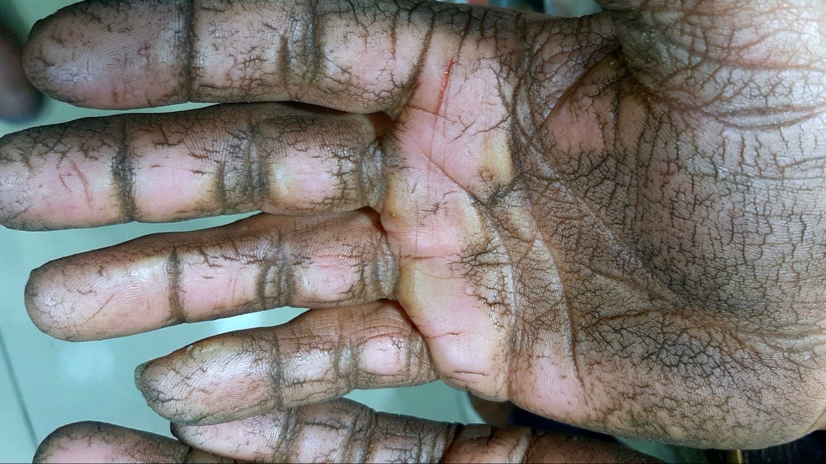 A life without security: breadwinners struggling in a stressful economy