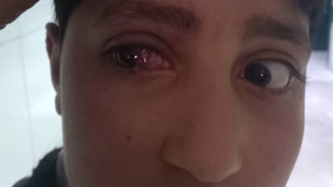 The abuse of a minor child in Sbeina raises calls for accountability